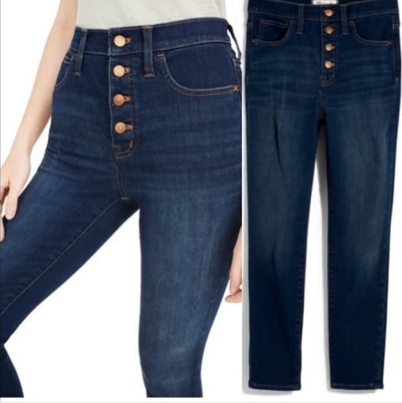 Madewell 10-inch High Waist Skinny Jeans: Button Front Edition In Cassia - Picture 3 of 16
